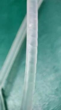 輸液器選擇不當(dāng)可能造成輸液泵不良事件